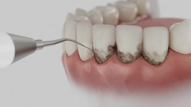 Trusted Tooth Extraction service in Palmetto, GA - Dentist Open Now